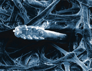 20110513031505demodex sem