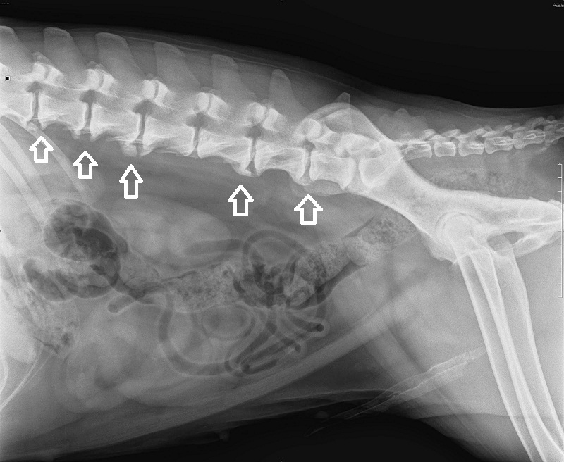 spondylose3