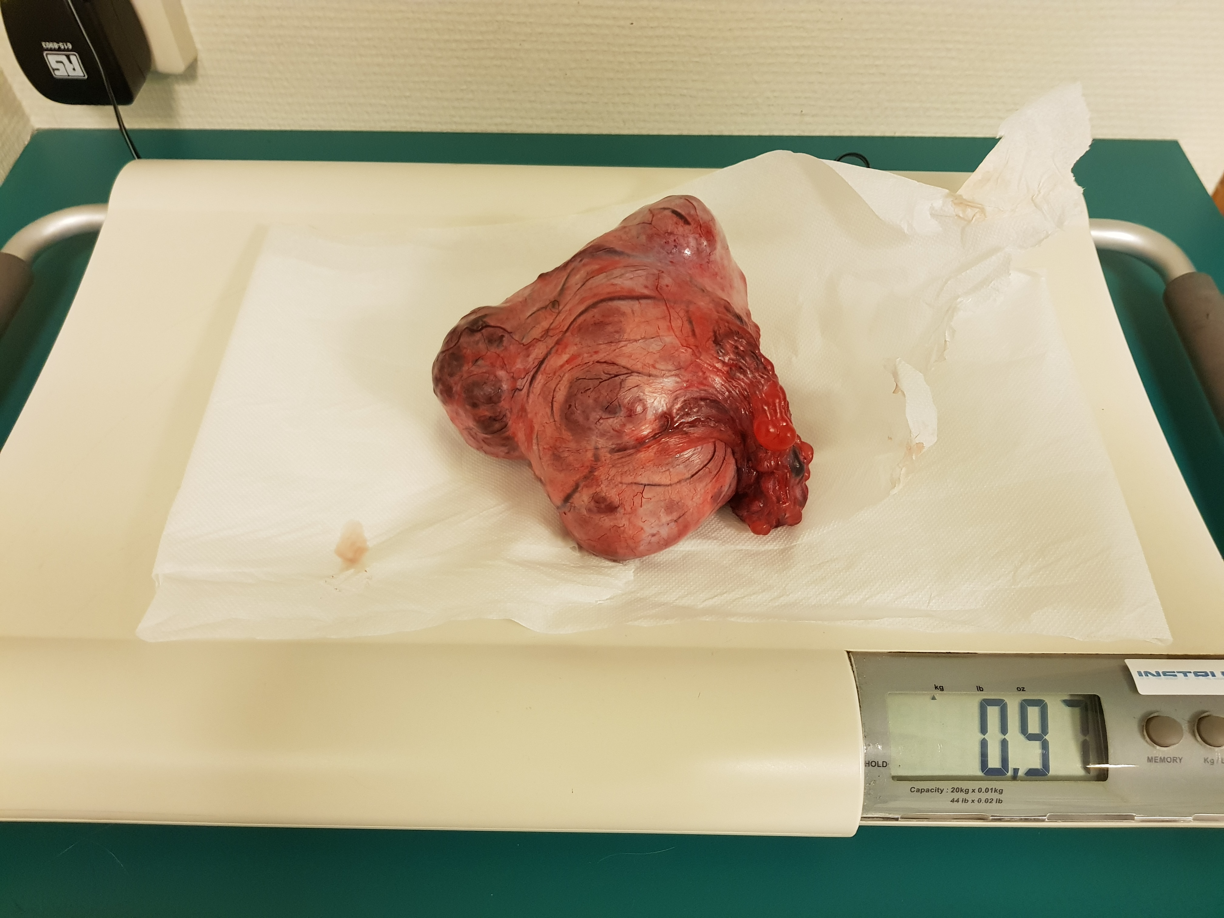 Testikeltumor