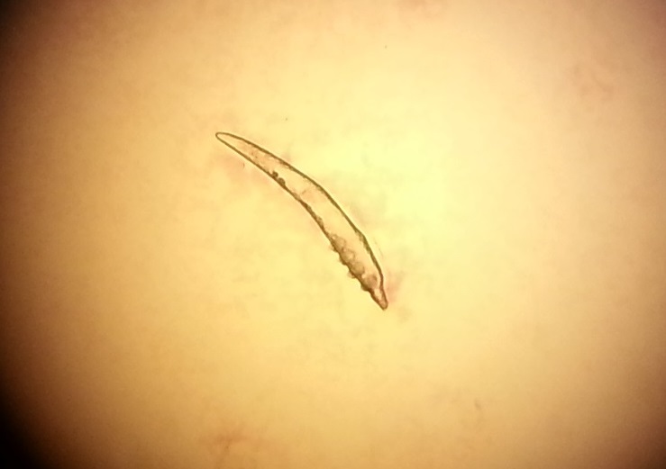 Demodex4