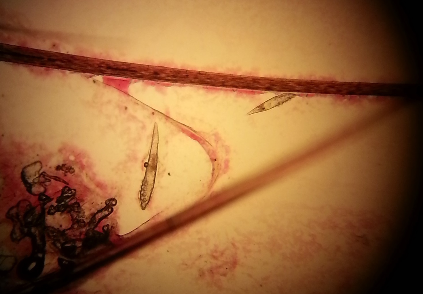Demodex5
